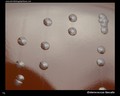 enterococcus faecalis